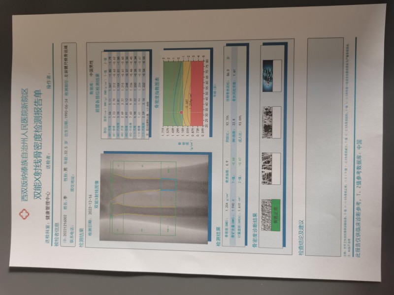 双能X射线骨密度仪报告单